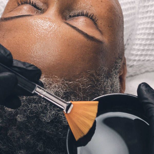 The VI Peel: Your Complete Guide to This Transformative Chemical Peel